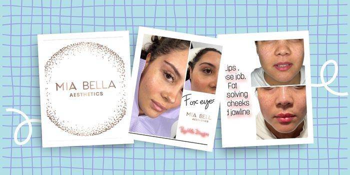 Mia Bella Aesthetics – Tratamientos de belleza latina en Londres