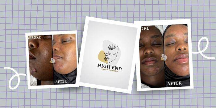 High End Medical Aesthetics – Estética latina en Londres